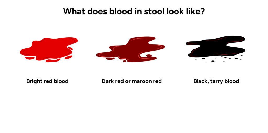 blog image health screening blood stool colors