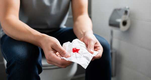 blood in stool what causes it and why it s dangerous
