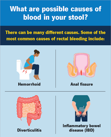 blood in stool