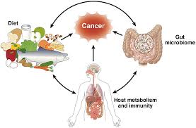 gut microbiome causing cancer