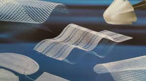 mesh