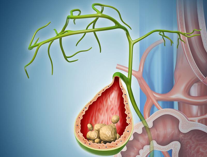 gallbladder 3