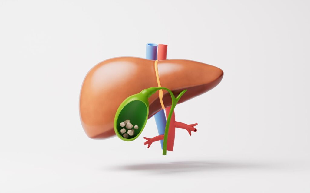 gallbladder2